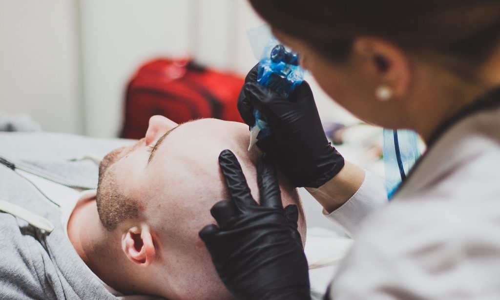 Booking a scalp micropigmentation consultation before treatment at mc scalp in hemel hempstead