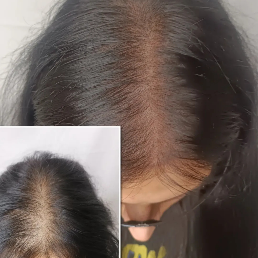 Female smp treatment for thinning hair with soft natural results by mc scalp hemel hempstead
